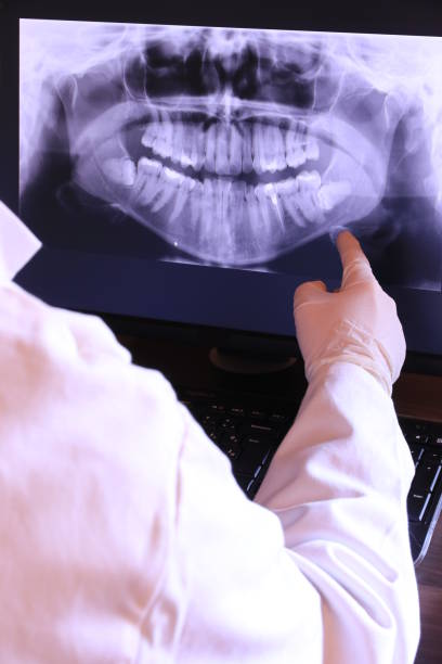 Best Broken or Chipped Tooth Repair in Genoa City, WI